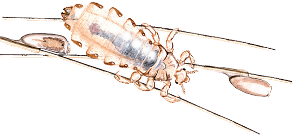headlice